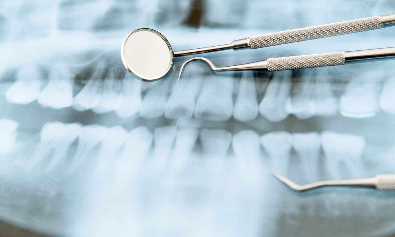 Dental x ray and three dental equipment lying on top of it